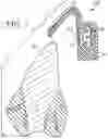Fig. 04 - Assemblies, methods, and kits including a compressible material
