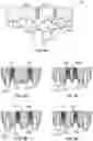Fig. 05 - Gingival ovate pontic and methods of using the same