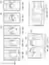 Fig. 07 - Gingival ovate pontic and methods of using the same
