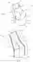 Fig. 03 - Two-part modelling aid