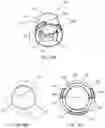 Fig. 11 - Two-part modelling aid