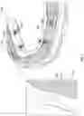 Fig. 02 - Dental prosthetic assemblies and coupling systems