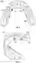 Fig. 06 - Dental prosthetic assemblies and coupling systems