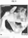 Fig. 05 - Mobile linked implant diagnosis system