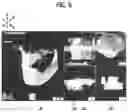 Fig. 07 - Mobile linked implant diagnosis system