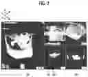 Fig. 08 - Mobile linked implant diagnosis system