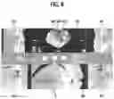 Fig. 09 - Mobile linked implant diagnosis system