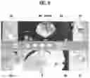 Fig. 10 - Image generation system for implant diagnosis and generation method thereof