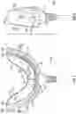 Fig. 02 - Mouthpiece for teeth whitening