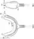 Fig. 05 - Mouthpiece for teeth whitening