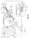 Fig. 10 - Surgical articles and methods