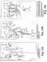 Fig. 12 - Surgical articles and methods