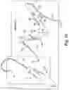 Fig. 15 - Surgical articles and methods