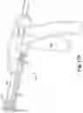 Fig. 20 - Surgical articles and methods