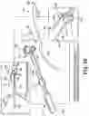 Fig. 23 - Surgical articles and methods