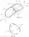 Fig. 17 - METHODS OF EMBOLIC DEFLECTION