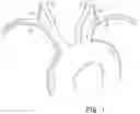 Fig. 02 - VASCULAR FILTERS, DEFLECTORS, AND METHODS