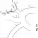Fig. 15 - VASCULAR FILTERS, DEFLECTORS, AND METHODS