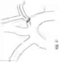 Fig. 17 - VASCULAR FILTERS, DEFLECTORS, AND METHODS