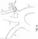 Fig. 21 - VASCULAR FILTERS, DEFLECTORS, AND METHODS