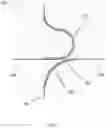 Fig. 05 - Stitch wire routing and delivery system