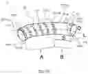 Fig. 04 - Blood conduit with stent
