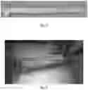 Fig. 09 - Blood conduit with stent