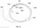 Fig. 10 - Blood conduit with stent