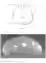 Fig. 03 - Systems, devices and methods of making mammary implants and tissue expanders having ribbed shells