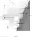 Fig. 25 - Systems, devices and methods of making mammary implants and tissue expanders having ribbed shells
