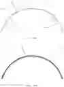 Fig. 52 - Systems, devices and methods of making mammary implants and tissue expanders having ribbed shells
