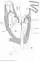 Fig. 01 - Methods for deploying a prosthetic mitral valve