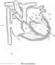 Fig. 02 - Methods for deploying a prosthetic mitral valve