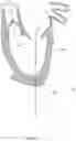 Fig. 07 - Methods for deploying a prosthetic mitral valve