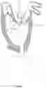 Fig. 09 - Methods for deploying a prosthetic mitral valve