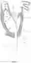 Fig. 12 - Methods for deploying a prosthetic mitral valve