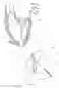 Fig. 13 - Methods for deploying a prosthetic mitral valve