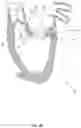 Fig. 14 - Methods for deploying a prosthetic mitral valve