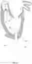 Fig. 15 - Methods for deploying a prosthetic mitral valve