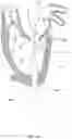Fig. 16 - Methods for deploying a prosthetic mitral valve