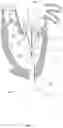 Fig. 17 - Methods for deploying a prosthetic mitral valve