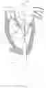 Fig. 18 - Methods for deploying a prosthetic mitral valve