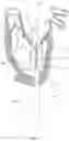 Fig. 19 - Methods for deploying a prosthetic mitral valve