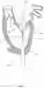 Fig. 20 - Methods for deploying a prosthetic mitral valve