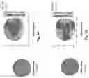 Fig. 06 - Flow optimized polymeric heart valve