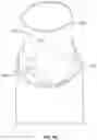 Fig. 12 - Flow optimized polymeric heart valve
