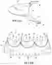 Fig. 04 - Heart valve prosthesis and methods of manufacture and use