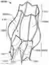 Fig. 01 - Prosthetic aortic heart valves