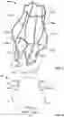Fig. 03 - Prosthetic aortic heart valves