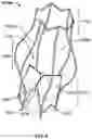 Fig. 05 - Prosthetic aortic heart valves